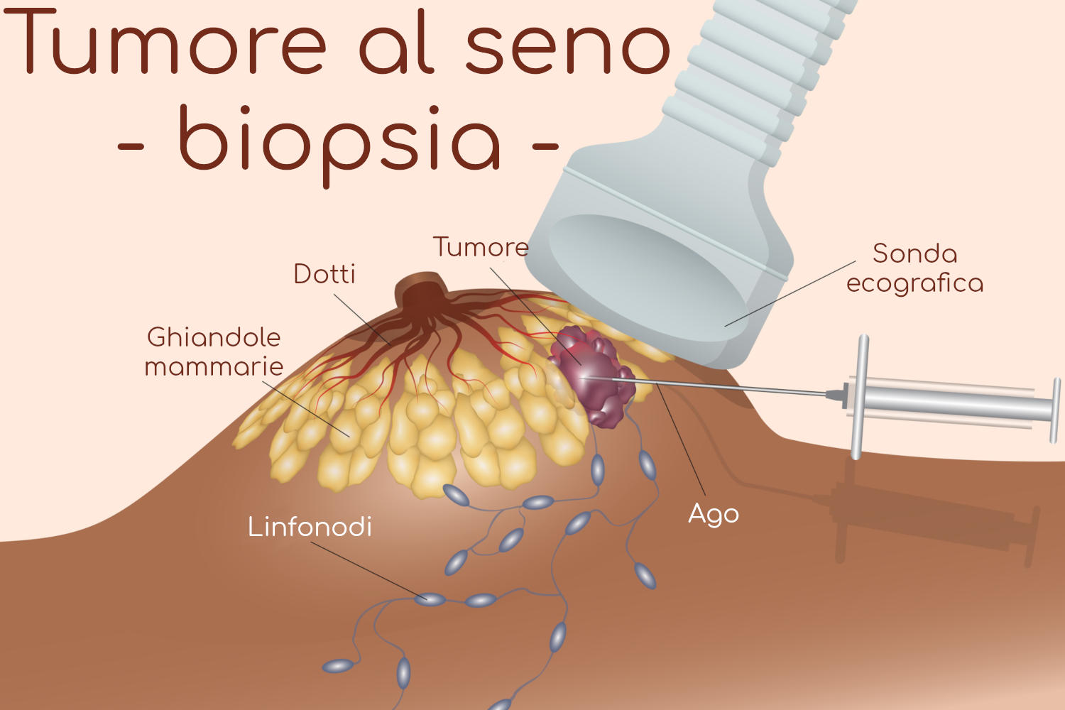 biopsia seno
